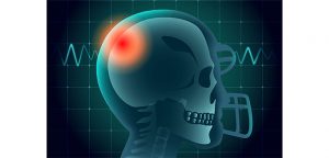 Technology, training are key in reducing concussion risks